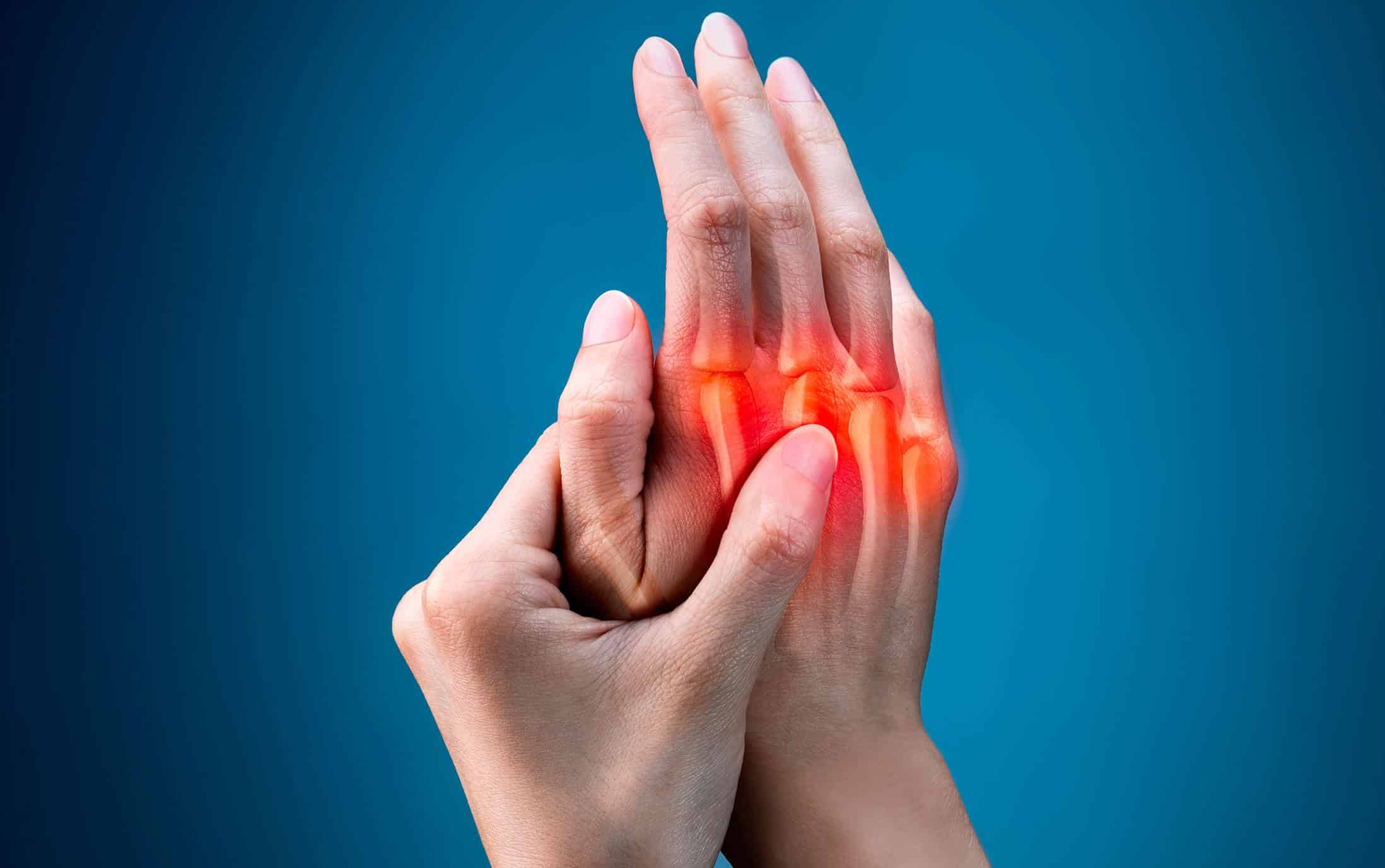 Rheumatische Schmerzen in der Hand